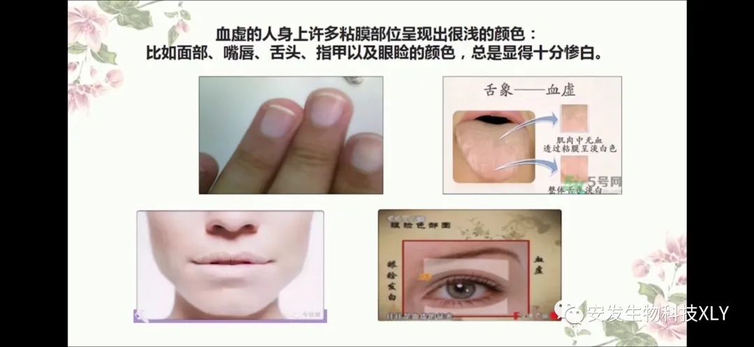 Manifestations and Regulation of Blood Deficiency