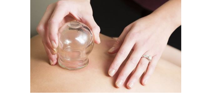 Cupping Therapy: A Traditional Chinese Medicine Approach to Health