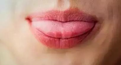 The Health of Your Body is Reflected on Your Tongue: Discover the Condition of Your Organs by Observing Your Tongue!
