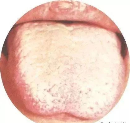130 High-Definition Tongue Diagnosis Charts (Recommended for Collection)