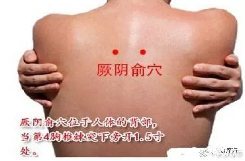 Comprehensive Guide to Cupping Therapy for the Back