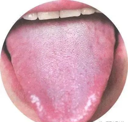 130 High-Definition Tongue Diagnosis Charts (Recommended for Collection)