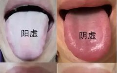 The Distinction Between Blood Deficiency and Yin Deficiency: Do Not Confuse Them!