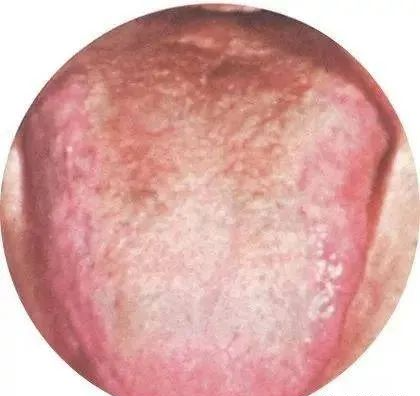 130 High-Definition Tongue Diagnosis Charts (Recommended for Collection)