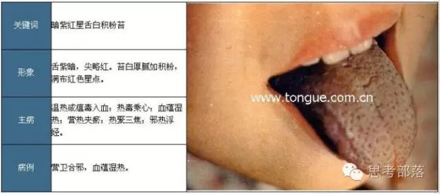 Comprehensive Guide to Tongue Diagnosis (8): 72 Types of Tongue Diagnosis Charts