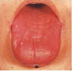 61 High-Definition Tongue Diagnosis Charts with Visual Comparisons