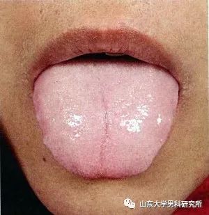 Understanding Qi Deficiency in Traditional Chinese Medicine