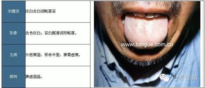 Comprehensive Guide to Tongue Diagnosis (8): 72 Types of Tongue Diagnosis Charts