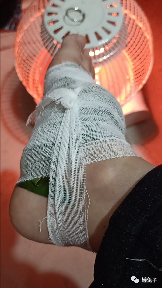 Case Study: The Miraculous Herb for Treating Ankle Sprains