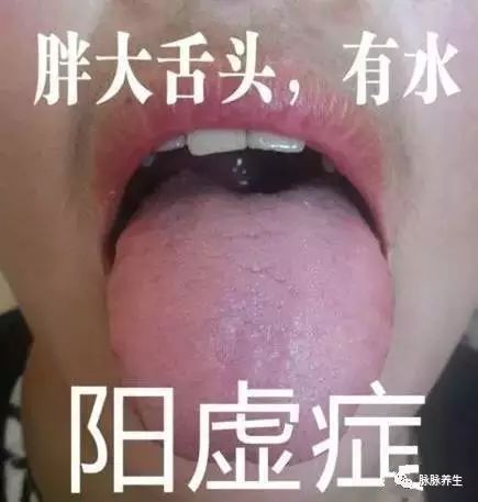 Tongue Diagnosis: A Clear Insight