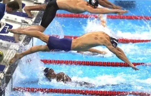 Cupping Therapy: Do You Really Understand It?