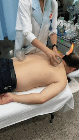 Understanding the TCM Balance Cupping Therapy