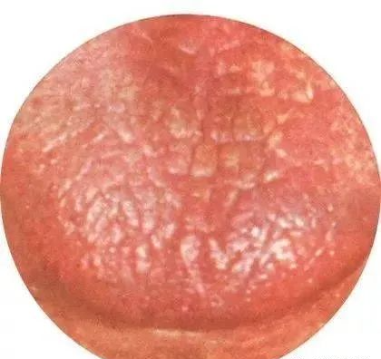 130 High-Definition Tongue Diagnosis Charts (Recommended for Collection)