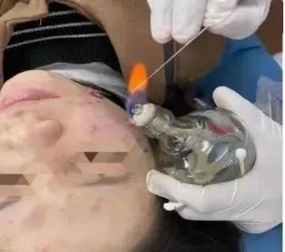 Acupuncture Department II: What Conditions Can Fire Needle Therapy Treat?