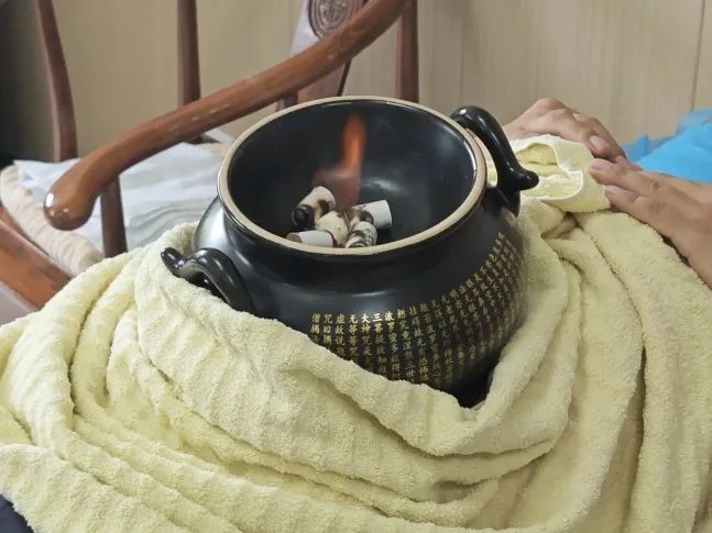 Traditional Chinese Medicine Therapy: Warming Yang Cupping