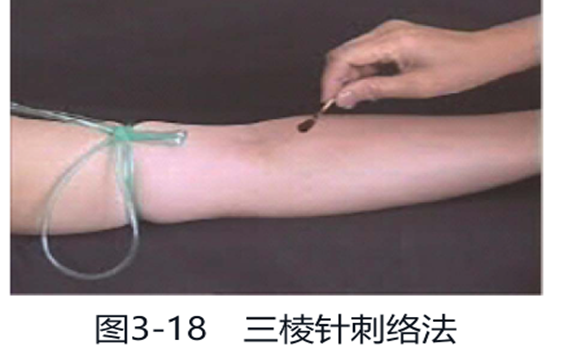 Bloodletting Therapy in Traditional Chinese Medicine (Part 1)