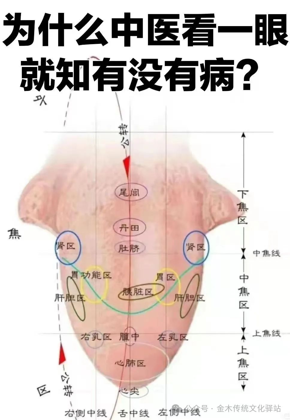 Traditional Chinese Medicine Tongue Diagnosis (Recommended for Collection)