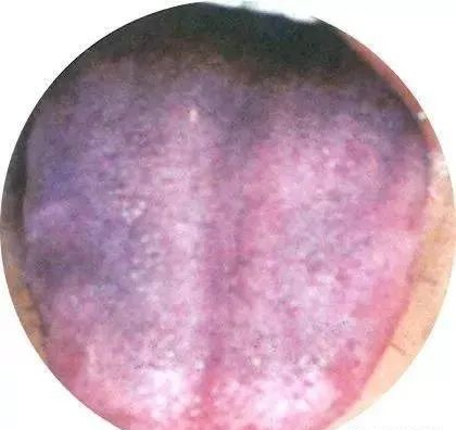130 High-Definition Tongue Diagnosis Charts (Recommended for Collection)