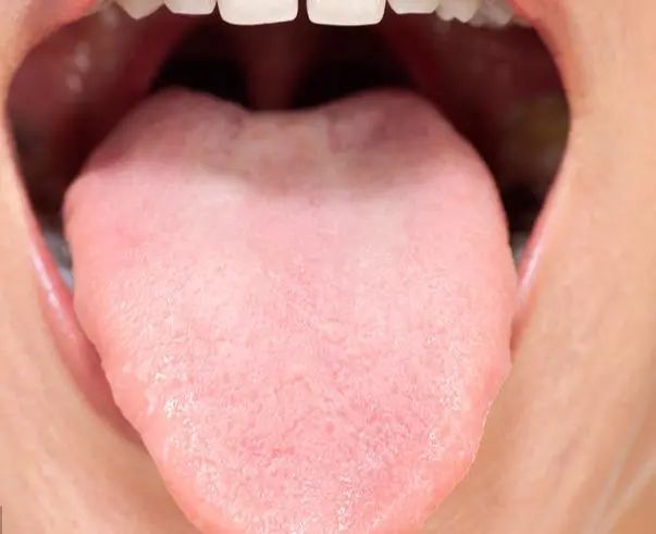 How to Observe Tongue Coating to Reflect Your Health