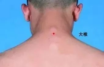 10 Gua Sha Techniques to Relieve Various Ailments Using a Spoon