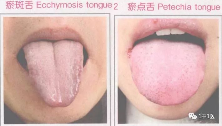 Learning Tongue Diagnosis from Scratch: Part 6 - Tongue Color 4