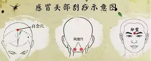 Gua Sha for All Ailments: The Importance of Correct Technique!