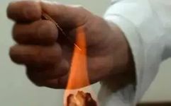 Fire Needle Therapy: Experience in Treating Seventeen Conditions, Practical Insights to Share!