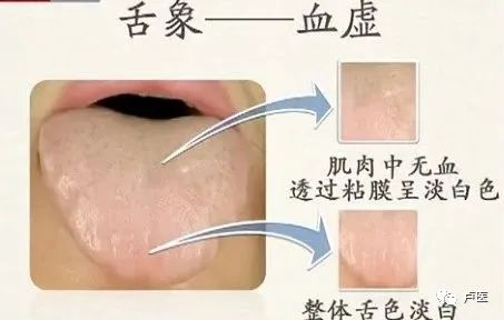 Exploring Tongue Diagnosis in Traditional Chinese Medicine: Hidden Insights and Tongue Diagnosis Atlas