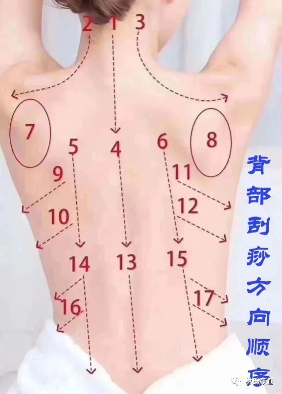 Key Points of Gua Sha