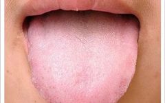 Traditional Chinese Medicine Tongue Diagnosis: 26 Clinical High-Definition Tongue Diagnosis Images with Analysis