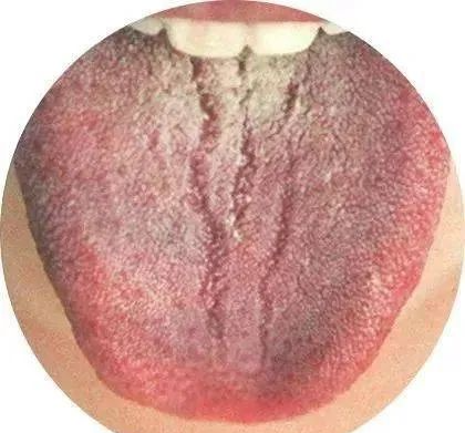 130 High-Definition Tongue Diagnosis Charts (Recommended for Collection)