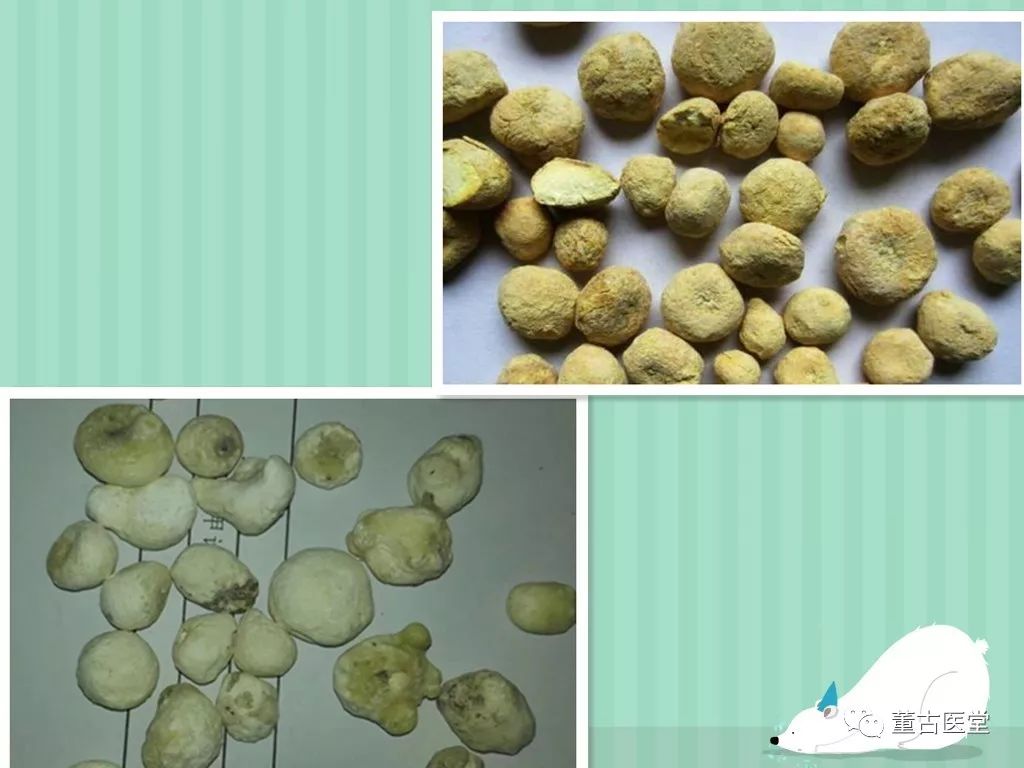 Clinical Application of Xuan Hua Pulse in TCM: A Case Study on Insomnia