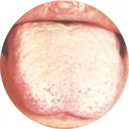 High-Definition Color Atlas of Tongue Diagnosis: Over 100 Types, The Most Comprehensive Ever! (Recommended for Collection)