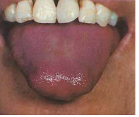 62 High-Definition Tongue Diagnosis Charts with Illustrations (Collector's Edition)