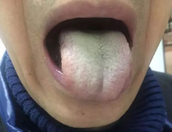 A Series on Tongue Diagnosis