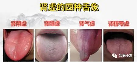 Classification of Qi Deficiency Symptoms, Chinese Patent Medicines for Qi and Kidney Deficiency, and Dietary Remedies for Qi Deficiency