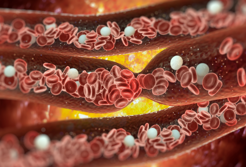 Blood Stasis Causes Various Illnesses: A TCM Approach to Unblock Blood Vessels and Eliminate Stasis!