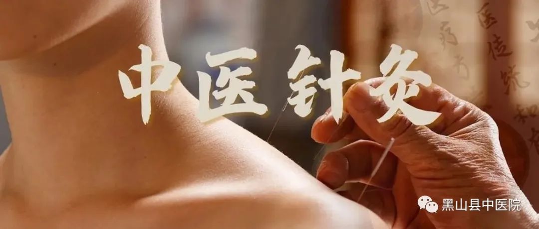 Traditional Chinese Medicine - Acupuncture