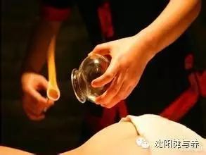 The Techniques and Diagnosis of Cupping and Sliding Cupping in Traditional Chinese Medicine