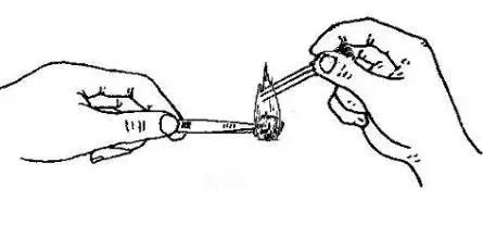 Characteristics of Fire Needle Therapy in Traditional Chinese Medicine