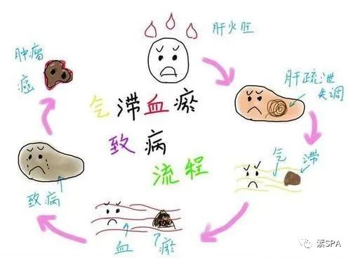 Traditional Chinese Medicine: The Root of All Illnesses is Blood Stasis