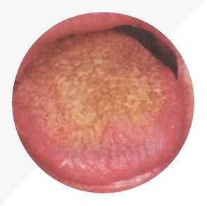 Analysis of High-Definition Tongue Diagnosis Charts: Understanding Health Through Your Tongue (Part 1)