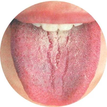High-Definition Color Atlas of Tongue Diagnosis: Over 100 Types, The Most Comprehensive Ever! (Recommended for Collection)