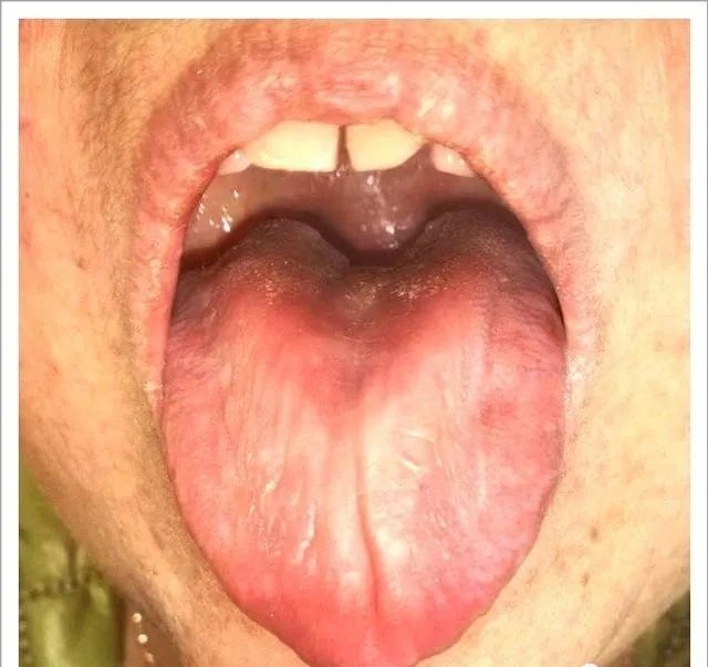 Traditional Chinese Medicine Tongue Diagnosis: 26 Clinical High-Definition Tongue Diagnosis Images with Analysis
