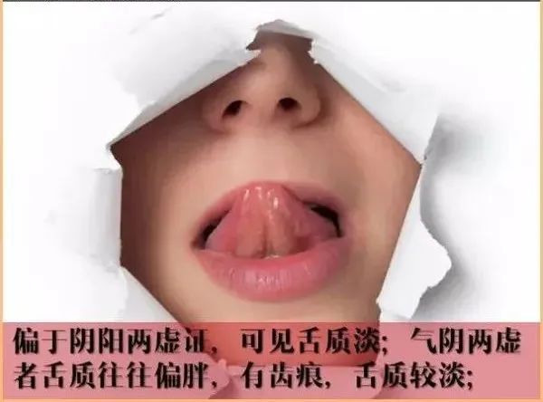 Comprehensive Guide to Observation Diagnosis in TCM