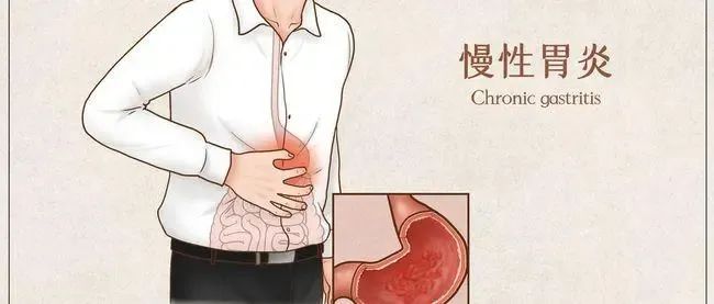 Differences Between Spleen-Stomach Yang Deficiency and Spleen-Stomach Damp-Heat