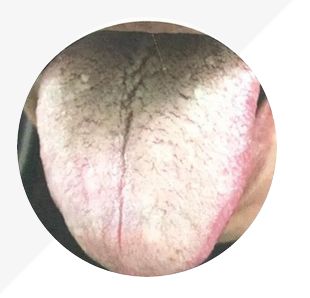Analysis of High-Definition Tongue Diagnosis Charts: Understanding Health Through Your Tongue (Part 1)