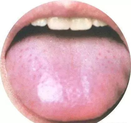 130 High-Definition Tongue Diagnosis Charts (Recommended for Collection)