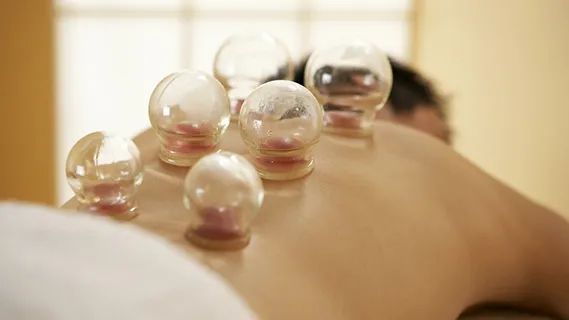 Cupping Therapy: A Traditional Chinese Medicine Approach to Health