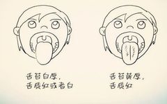 Reference for Combined Treatment of Wind-Cold and Wind-Heat Colds